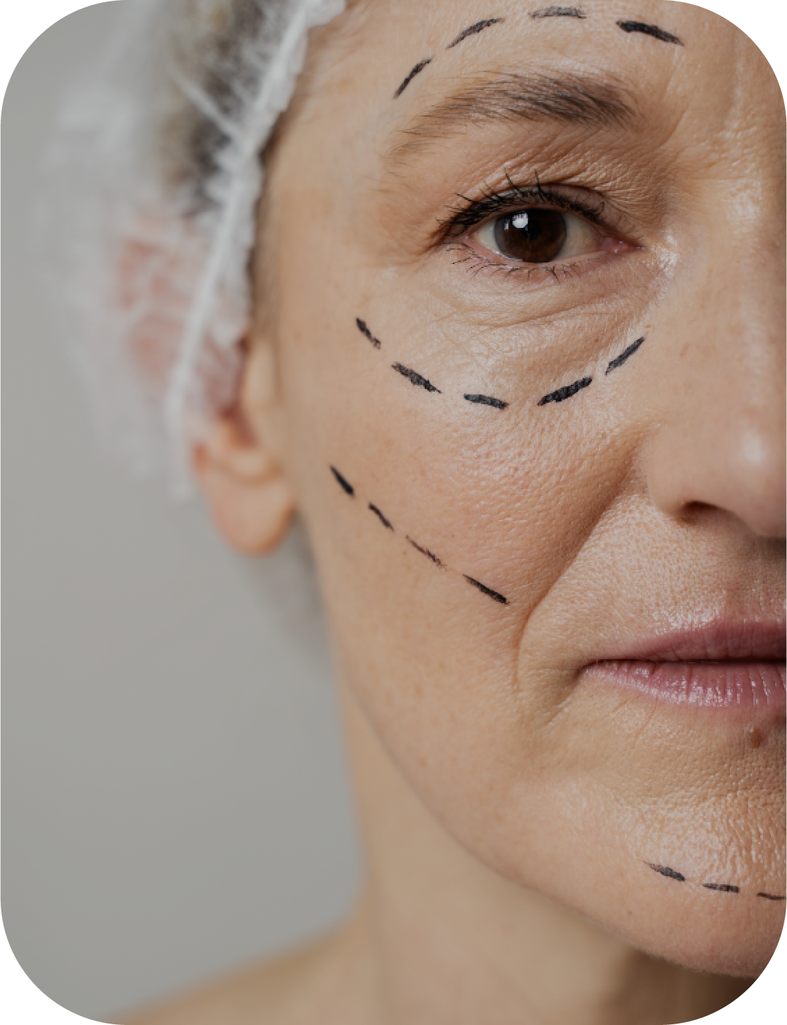 Anti-Aging &  Wrinkle Treatments