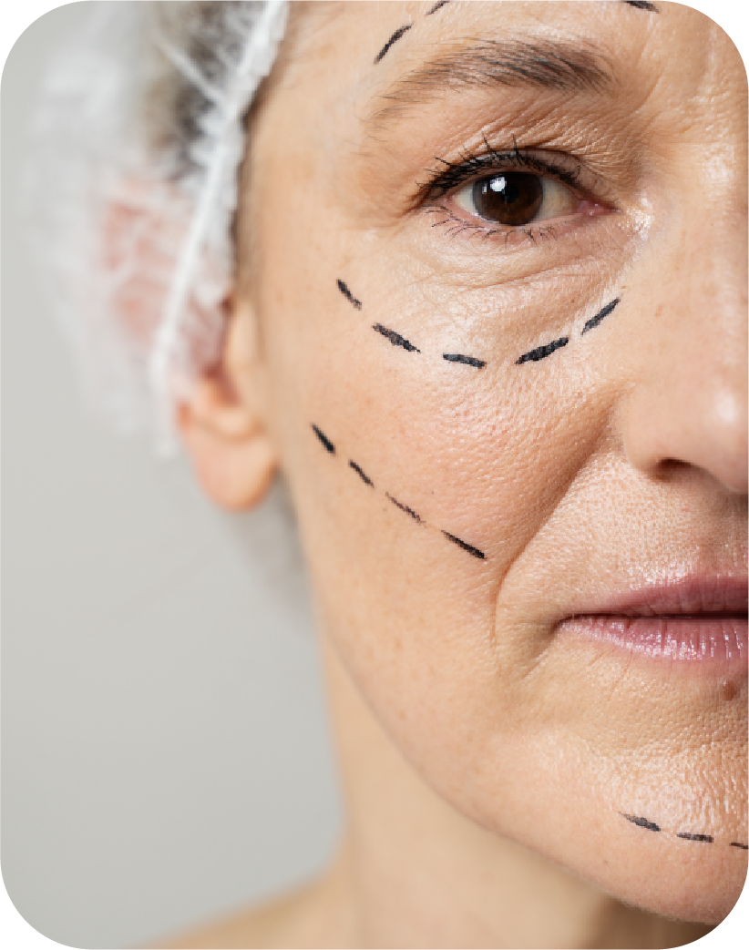 Anti-Aging &  Wrinkle Treatments at Lulu Beauty Studio