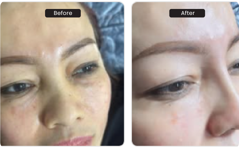 Skin Brightening & Glow Treatments